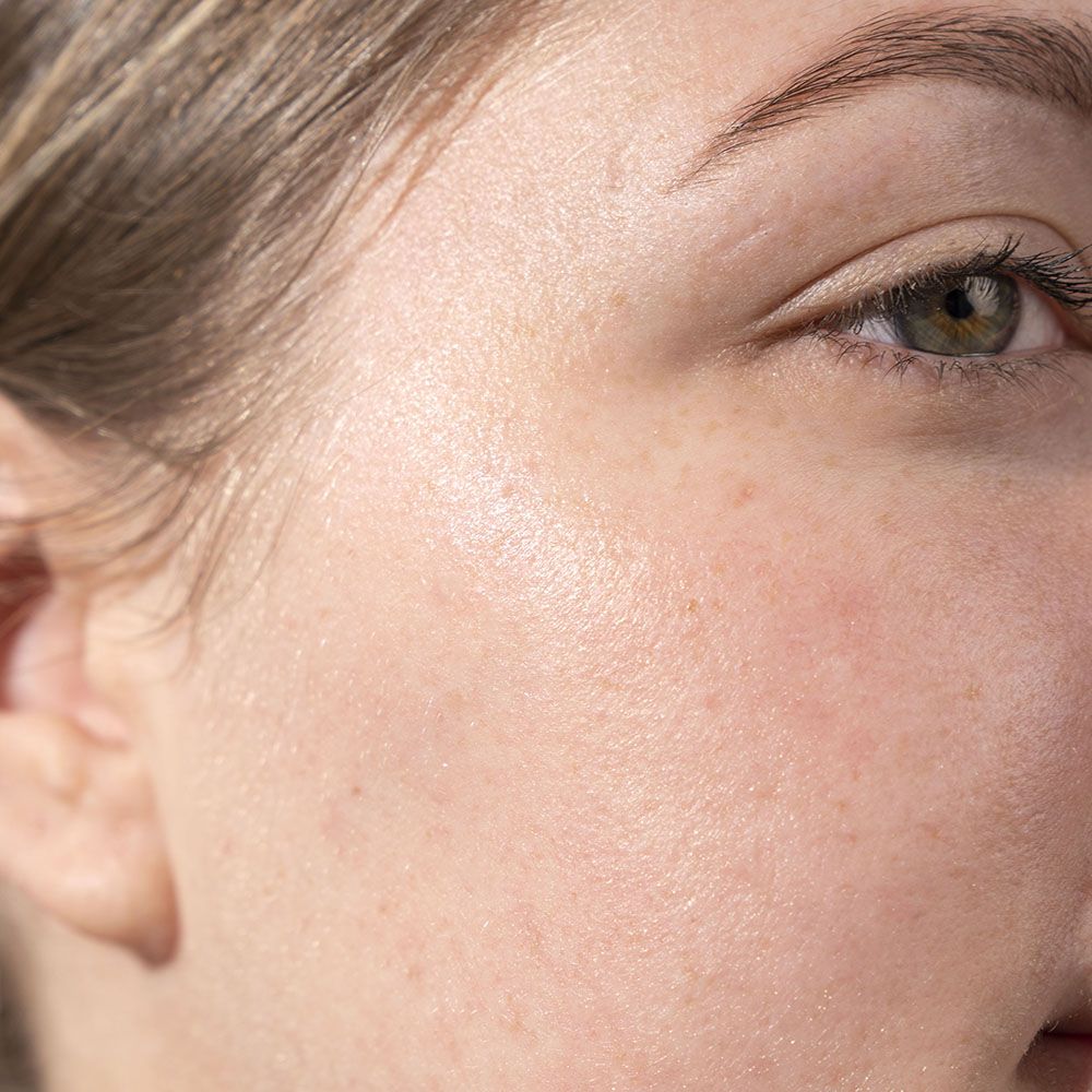 Multi-Functional Peel